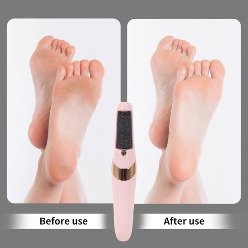 ইলেকট্রিক ফুট পেডিকিউর টুলস, রিচার্জেবল ফুট ক্যালাস রিমুভার পেডিকিউর মেশিন